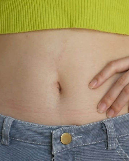 Belly Button clean-baoer