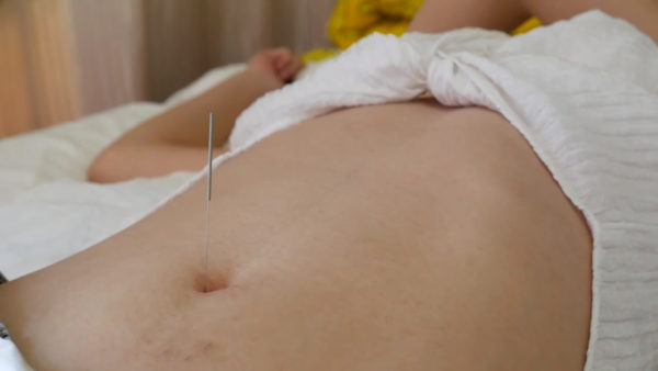 Belly Button（navel）Needle Torture-dingding