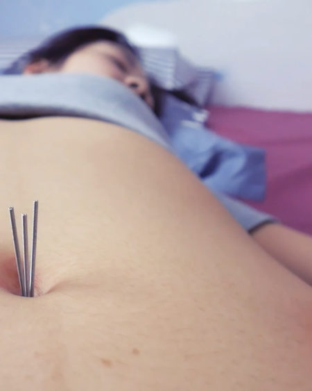 Needle belly button-Sasa