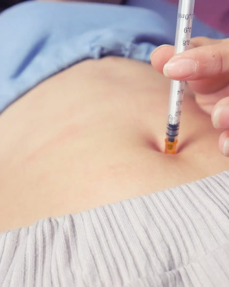 Needle belly button-Bonny