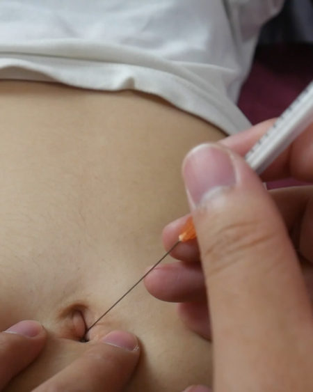 Crazy needle belly button-Moon and Bubles