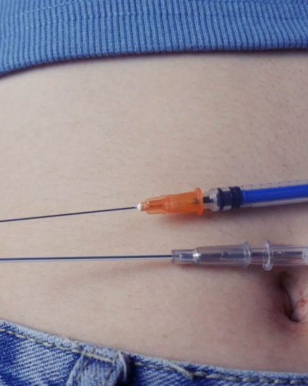 Crazy navel needle 5-Moon