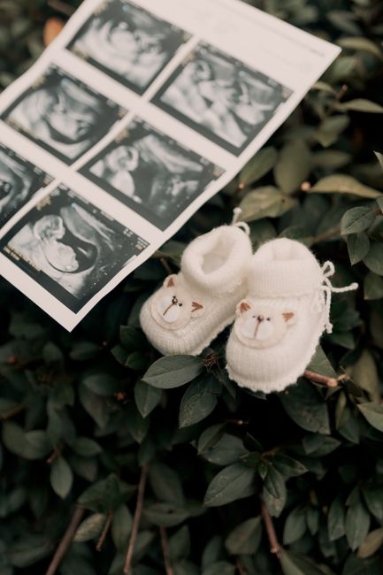 A pair of baby shoes next to an ultrasound image on green leaves